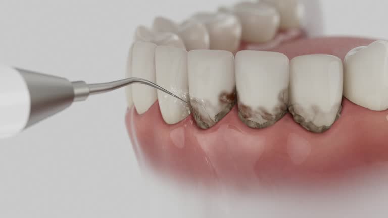 Reliable Dental Implants contractor in Benson, NC by Smile Center Dentistry